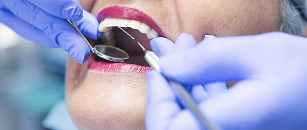 Best Lost Filling or Crown Replacement in Okawvle, IL